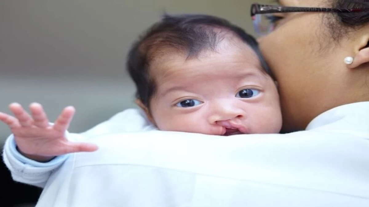 Dudak ve Damak Yarığında Modern Cerrahi Yaklaşım: Op. Dr. G&ouml;khan Semerci ile Hayata Daha G&uuml;venli Bir Başlangı&ccedil;